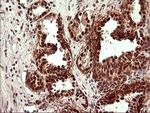 UPRT Antibody in Immunohistochemistry (Paraffin) (IHC (P))