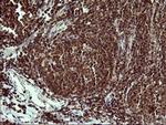 UPRT Antibody in Immunohistochemistry (Paraffin) (IHC (P))