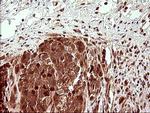 UPRT Antibody in Immunohistochemistry (Paraffin) (IHC (P))