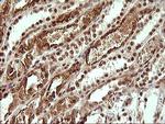 UPRT Antibody in Immunohistochemistry (Paraffin) (IHC (P))