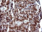 UPRT Antibody in Immunohistochemistry (Paraffin) (IHC (P))