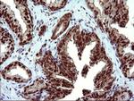 UPRT Antibody in Immunohistochemistry (Paraffin) (IHC (P))