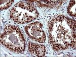 UPRT Antibody in Immunohistochemistry (Paraffin) (IHC (P))