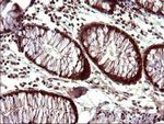 UPRT Antibody in Immunohistochemistry (Paraffin) (IHC (P))