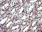 UPRT Antibody in Immunohistochemistry (Paraffin) (IHC (P))