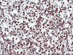 UPRT Antibody in Immunohistochemistry (Paraffin) (IHC (P))