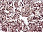 UPRT Antibody in Immunohistochemistry (Paraffin) (IHC (P))