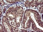 UPRT Antibody in Immunohistochemistry (Paraffin) (IHC (P))