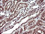 UPRT Antibody in Immunohistochemistry (Paraffin) (IHC (P))