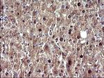 UPRT Antibody in Immunohistochemistry (Paraffin) (IHC (P))