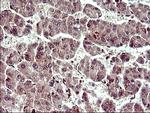 UPRT Antibody in Immunohistochemistry (Paraffin) (IHC (P))