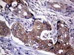 UPRT Antibody in Immunohistochemistry (Paraffin) (IHC (P))