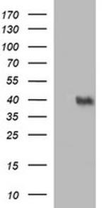 UPRT Antibody in Western Blot (WB)