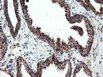 UQCRC1 Antibody in Immunohistochemistry (Paraffin) (IHC (P))