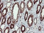 UQCRC1 Antibody in Immunohistochemistry (Paraffin) (IHC (P))