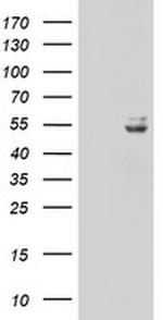 UQCRC1 Antibody in Western Blot (WB)