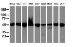 UQCRC1 Antibody in Western Blot (WB)