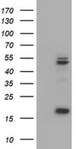 UQCRC1 Antibody in Western Blot (WB)