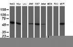 UQCRC1 Antibody in Western Blot (WB)