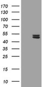 UQCRC1 Antibody in Western Blot (WB)