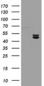 UQCRC1 Antibody in Western Blot (WB)