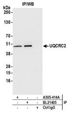 UQCRC2 Antibody in Western Blot (WB)