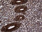 UQCRFS1 Antibody in Immunohistochemistry (Paraffin) (IHC (P))