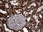 UQCRFS1 Antibody in Immunohistochemistry (Paraffin) (IHC (P))