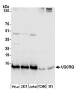 UQCRQ Antibody in Western Blot (WB)