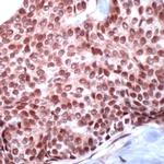 USF2 Antibody in Immunohistochemistry (Paraffin) (IHC (P))