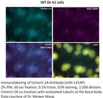 Usherin Antibody in Immunohistochemistry (IHC)