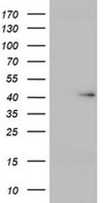 USP12 Antibody in Western Blot (WB)