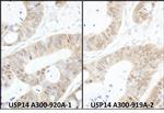 USP14 Antibody in Immunohistochemistry (IHC)