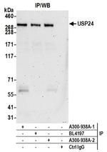 USP24 Antibody in Western Blot (WB)