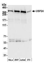 USP24 Antibody in Western Blot (WB)