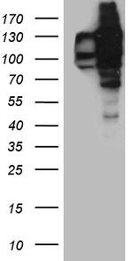 USP25 Antibody in Western Blot (WB)