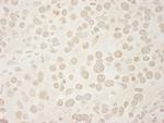 USP33 Antibody in Immunohistochemistry (IHC)