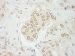 USP33 Antibody in Immunohistochemistry (IHC)