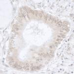 USP36/DUB1 Antibody in Immunohistochemistry (IHC)