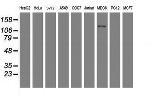 USP36 Antibody in Western Blot (WB)