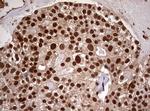 USP44 Antibody in Immunohistochemistry (Paraffin) (IHC (P))