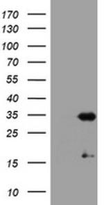 USP44 Antibody in Western Blot (WB)