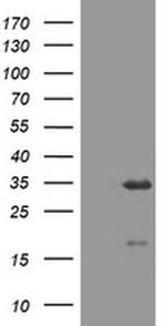 USP44 Antibody in Western Blot (WB)