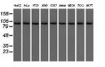 USP5 Antibody in Western Blot (WB)