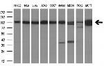 USP5 Antibody in Western Blot (WB)