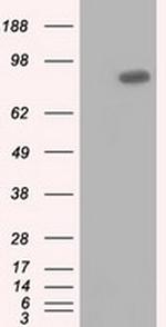 USP5 Antibody in Western Blot (WB)