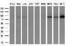 USP5 Antibody in Western Blot (WB)