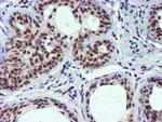 USP7 Antibody in Immunohistochemistry (Paraffin) (IHC (P))