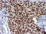 USP7 Antibody in Immunohistochemistry (Paraffin) (IHC (P))