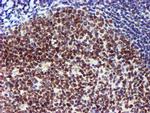 USP7 Antibody in Immunohistochemistry (Paraffin) (IHC (P))